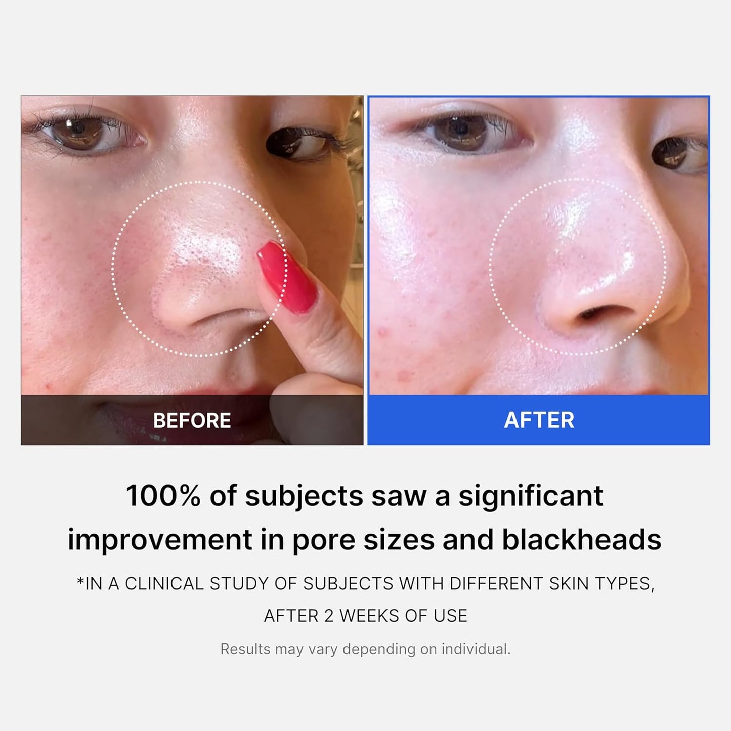 Zero Pore Pads 2.0, Dual-Textured Facial Toner Pads for Exfoliation and Pore Care with 4.5% AHA Lactic Acid & 0.45% BHA Salicylic Acid, Ideal for All Skin Types, Korean Skin Care (70 Pads)