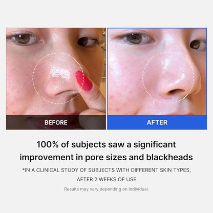 Zero Pore Pads 2.0, Dual-Textured Facial Toner Pads for Exfoliation and Pore Care with 4.5% AHA Lactic Acid & 0.45% BHA Salicylic Acid, Ideal for All Skin Types, Korean Skin Care (70 Pads)